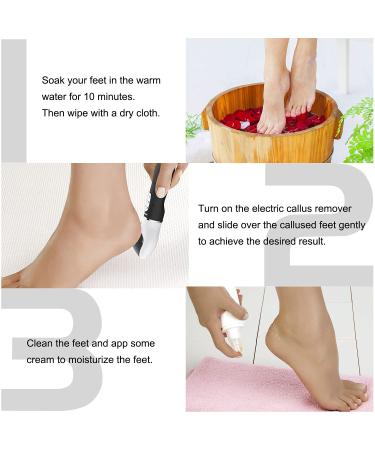 Rechargeable Electric Callus Remover for Feet - Professional Pedicure Tool with 3 Speeds and 4 Refill Rollers - Best Foot File Kit for Dead Skin Removal (Black) - Buy Online on GoSupps.com