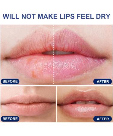 Hydrating and Moisturizing Lip Balm - Lip Care for Chapped Lips - Smooth Lip Repair Lip Balm 22g - Lip Care for Lasting Moisturizing - Spf Lip Balm for Dry Cracked Lips - Buy Online on GoSupps.com