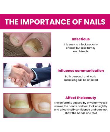  G n rique Nail Hardener Nails Nutrient Oil 10ml Natural Cuticle Oils Repair Softener Optimal Nail Revitalization for Foot Care Fingernails Yellow Toenail Ingrown Women and Men - Buy Online on GoSupps.com