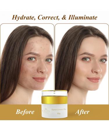 KAIITS Pigment Corrector Plus. Radiance Boosting Hyperpigmentation Face Cream with Vitamin E Hyaluronic Acid & Alpha Arbutin Eraser for Discolored and Hyperpigmented Skin |1.7oz - Buy Online on GoSupps.com
