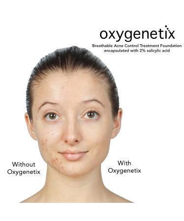 Oxygenetix Acne Control Foundation - 15ml - Almond | Long-lasting Coverage for Acne-prone Skin - Buy Online on GoSupps.com