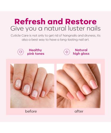 Modelones Cuticle Remover Kit - 7 Piece Set for DIY Nail Care | Cream Oil Trimmer Pusher & Nipper - Best Cuticle Care Solution - Buy Online on GoSupps.com