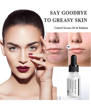 5% Niacinamide Face Serum Dark Spot Correcting Glow Serum Day & Night Serum for Dry &Sensitive Skin Balanced Grease Pore Contraction -Fade Acne Marks Facial Serum Anti Aging Face Cream Skin Repair - Buy Online on GoSupps.com