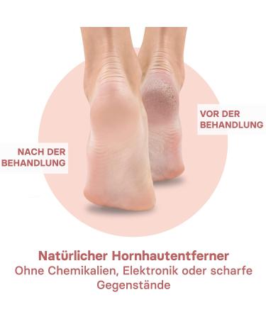 Valneo Footfish: Wooden Coarse & Fine Cornel Files for Dry Skin - Effective Hand & Foot Care Tool - Buy Online on GoSupps.com