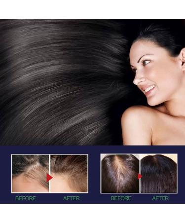 Blusoms Hairgrowth Formula Serum Spray - Set of 2 | Promotes Healthy Hair Growth - Buy Online on GoSupps.com