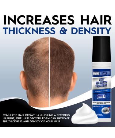 Natural Hair Growth Foam - Biotin & Keratin Formula for Men & Women | Promotes Regrowth & Strength - Pack of 3 (1.22 oz - Buy Online on GoSupps.com