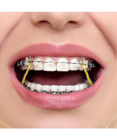 JMU Orthodontic Elastics 3/16 Medium 500-Pack - Made in USA Latex Dental Rubber Bands - Buy Online on GoSupps.com