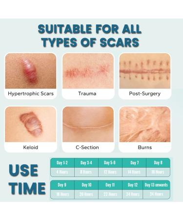Medical Grade Silicone Scar Sheets (2 Rolls) - Acne, Burn, C-Section, Keloid Treatment - 8 Month Supply - Buy Online on GoSupps.com