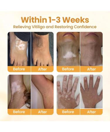  Hjatirace Skin Care Cream Brightening Formula 30G Foot Nourishing Lotion Brightening Foot Moisturizer Non-Greasy Texture For Women Adults Daily Use - Buy Online on GoSupps.com