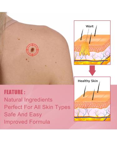 KOAHDE Rose Oil Soap Natural Extract Soap Gentle Safe Suitable for All Skin Types 80G - Buy Online on GoSupps.com