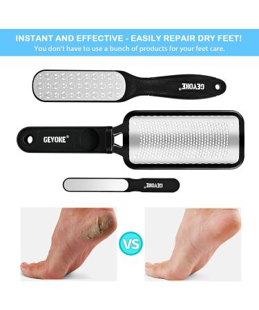 Gevoke Foot File Callus Remover Set - 3 Pcs Stainless Steel Foot Rasp for Dead Skin & Cracked Heels - Shower Foot Scrubber for Smooth Feet - Surgical Grade Heel Scraper F02 - Buy Online on GoSupps.com