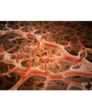 Posterazzi Microscopic view Athlete's fungus also known as ringworm of the foot and tinea pedis is a fungal infection of the skin Poster Print (32 x 24)