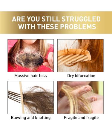 50g Hair Scalp Exfoliating Scrub Anti Hair Loss Treatment for Dandruff Flakes & Oily Scalp Nourishes Hair Follicles & Promotes Thicker Healthier Hair Growth - Buy Online on GoSupps.com