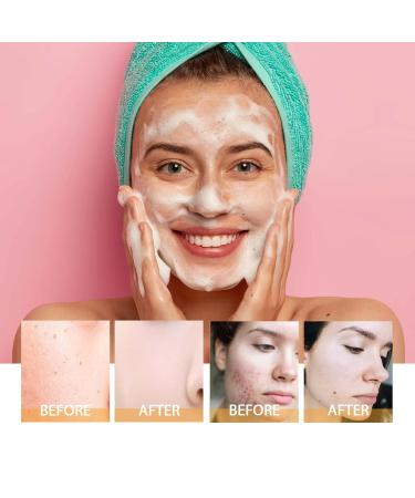 Turmeric Facial Cleanser & Foaming Wash for All Skin Types - 2 Pcs | International Shipping - Buy Online on GoSupps.com