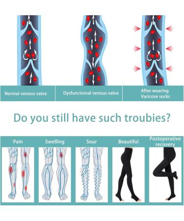 Shop Evolyline 20-30MMHG Medical Compression Tights for Women & Men - Class II Support Stockings for Varicose Veins Edema & Pregnancy - Open Toe Black XXL - Buy Online on GoSupps.com