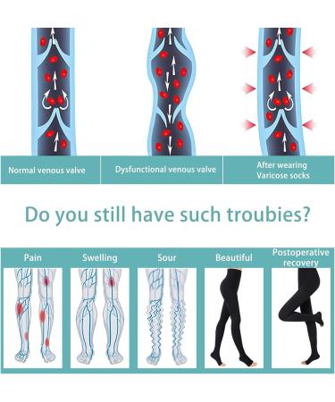 Evolyline 20-30 mmHg Medical Compression Tights | Open Toe Graduated Support Pantyhose | Compression Socks for Varicose Veins & Edema | Black XXL - Buy Online on GoSupps.com