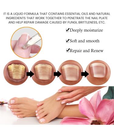 Cuticle Oil for Nails Nail Oil Cuticle with Vitamin E Soothe Moisturize Nail Cuticle Oil Moisturizes Cuticle and Nail's Skin Strengthens Nails Prevents Hangnails and Chapped 15ML - Buy Online on GoSupps.com
