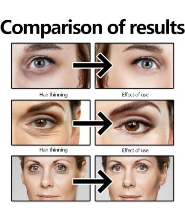 Instant Face Lift Cream Harvey Ross Fast Acting Firming Eye Cream Anti Aging Face Moisturizer Eye Cream for Puffiness and Bags - Buy Online on GoSupps.com