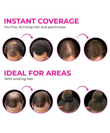 VELO Hair Building Fibers for Thinning Hair - Dark Brown 30g | Instant Volume & Fuller Look for Men & Women - Conceals Hair Loss Long Lasting Solution - Buy Online on GoSupps.com