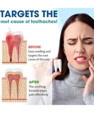 Tooth Spray for Gum Care & Inflammation - Oral Care Spray 30ml - Blue Size | International Shipping Available - Buy Online on GoSupps.com