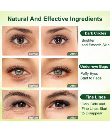 Under Eye Patches Reusable Collagen Eye Patches Anti Wrinkle Eye Gel Masks for Puffy Eyes Moisturising Dark Circles Under Eye Women Under Eye Bags Removal Stickers Hydrating Skincare 30 Pairs - Buy Online on GoSupps.com