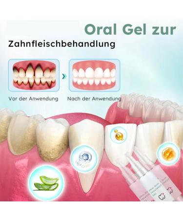 Buy Neslemy Oral Gum Treatment Gel (5pcs) - Effective Gum Protection Therapy for Healthy Gums | International Shipping Available - Buy Online on GoSupps.com