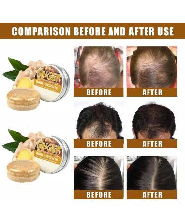 Ginger Shampoo Bar. Ginger Shampoo Soap for Men and Women (2PCS) - Buy Online on GoSupps.com