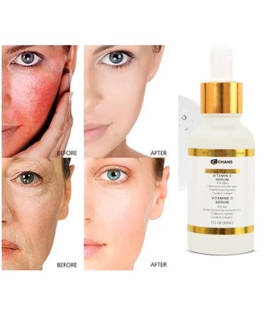 CCHANS 4in1 Vitamin C SERUM Anti-Aging Moisturizing Retinol Organic lightening serum Hyaluronic Acid & Niacinamide Dark spots serum Pura Serum Fine Lines & Wrinkles Korean Serum1 Fl Oz 30ML. - Buy Online on GoSupps.com
