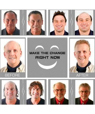 Gray white Human Hair Toupee for men NLW European human hair pieces for men Hair unit replacement System Man piece soft (White-Full Lace base) #White Full Lace - Buy Online on GoSupps.com