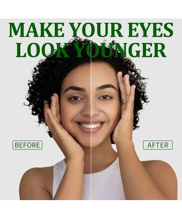 R.A.V Green Tea Under Eye Patches with Hyaluronic Acid & Collagen - 30 Pairs - Buy Online on GoSupps.com