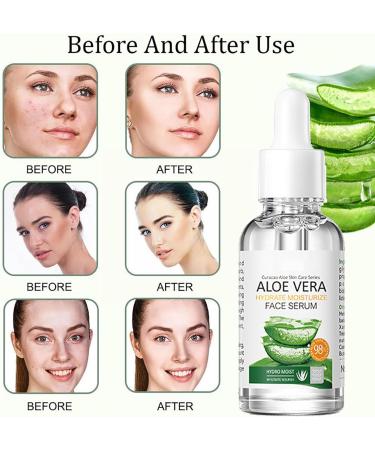 Aloe Vera Skincare Gift Set for Women - 8PCS Pamper Kit with Cleanser, Lip Balm, Eye Cream, Toner, Face Cream, Serum, Hand Cream - Hydrating & Refreshing Gift Set - Buy Online on GoSupps.com