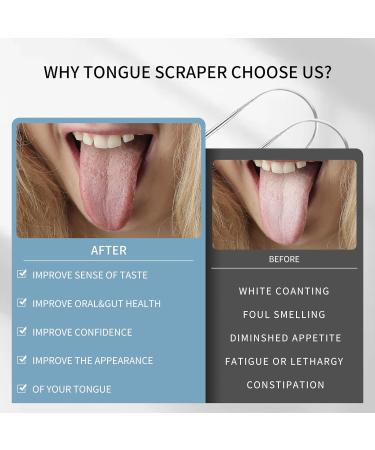 Liatinbo Tongue Scraper - Stainless Steel Tongue Scraps for Adults | Reduces Bad Breath & Promotes Freshness | 2 U-Shaped Pieces - Buy Online on GoSupps.com