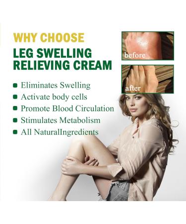 Antihump Lymphcare Ginger Ointment Antihump Ginger Ointment Ginger Legs Anti Swelling Cream Ginger Anti Cellulite Ointment Anti Cellulite Ointment Ginger Soothing Cream Anti Cellulite Leg Ointment 2PC - Buy Online on GoSupps.com