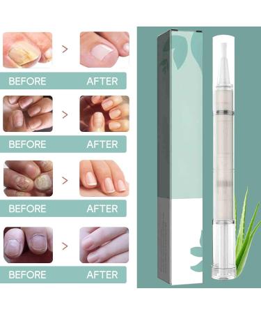 TaimeiMao 5 pieces Nail Care Nail Care Stick Nail Oil Pen Routine Nail Care - Buy Online on GoSupps.com