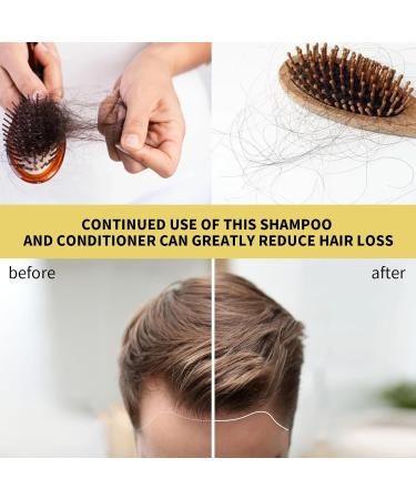 Shantou Yingji 2 pieces ginger shampoo Ginger Hair Regrowth Shampoo ginger itch relieving care shampoo hair strengthening shampoo fluffy nourishing shampoo 2 pieces x 100 ml hair2 pieces - Buy Online on GoSupps.com