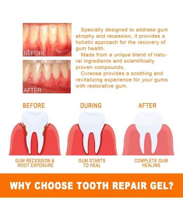 Fivfivgo Tooth Whitening & Gum Repair Ampoule Serum - 1 Piece for Enhanced Oral Care - Buy Online on GoSupps.com