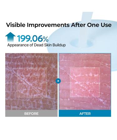 Dr.Melaxin TX Peel Shot Body Exfoliating Spray with Tranexamic Acid & Niacinamide Brightening Body Care for Uneven Skin Tone 200ml - Buy Online on GoSupps.com