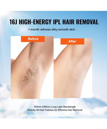 VEVOR IPL Laser Hair Removal Device - 16J Epilator with 4.0m Area 5-Stage Intensity Sapphire Cooling & 400 000 Impulses - International Shipping Available - Buy Online on GoSupps.com