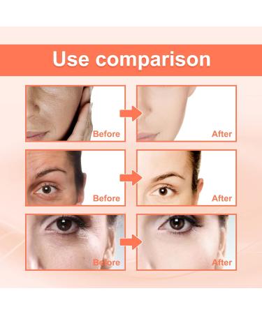 Rose Essential Oil Facial Oil to Visibly Firm Hydrate and Reveal Radiant Skin Squalane + Vitamin C Rose Oil - Buy Online on GoSupps.com