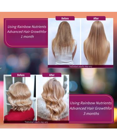 Vitamines pour la croissance des cheveux pour les femmes | Biotine Collag ne Saw Palmetto | Des cheveux une peau et des ongles plus sains | Peut arr ter la perte de cheveux (paquet de 2) - Buy Online on GoSupps.com