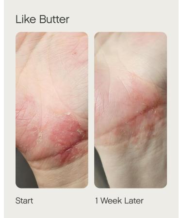 Topicals Ultimate Bundle: Faded Serum for Dark Spots & Like Butter Moisturizer for Dry Sensitive Eczema-Prone Skin - 1.7 Fl Oz Each | Ships Internationally - Buy Online on GoSupps.com