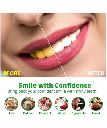Amore Paris Teeth Whitening Powder Hsadav Amore Paris Teeth Whitening Powder Activated Coconut Charcoal Teeth Whitening Effectively Removes Coffee and Tobacco Stains - Buy Online on GoSupps.com
