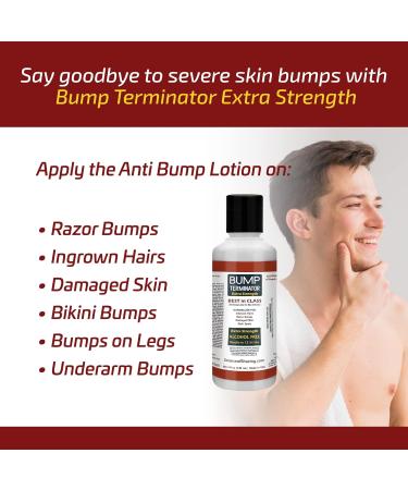 Bump Terminator Extra Strength Alcohol-Free Lotion - Razor Bump Treatment for Men & Women | 4oz - Buy Online on GoSupps.com