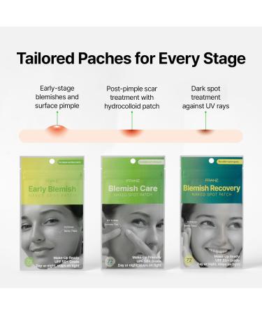 FRANZ Dark Spot Treatment UV Patch - Green Tea & Niacinamide Korean Skincare for Makeup Ready Matte Finish - Non-Creasing Longwear - Buy Online on GoSupps.com
