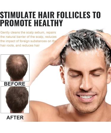 Tindedly Root Activating Shampoo Hair Regrowth Shampoo Shampoo For Gray Hair Shampoo For White Hair Natural Formula For Thicker Hair(3pcs) - Buy Online on GoSupps.com