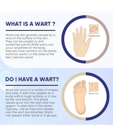 Wart Remover Liquid Fast Acting Salicylic Liquid to Remove Common and Plantar Warts Flat Warts 0.7 Fl Oz 1 Count - Buy Online on GoSupps.com