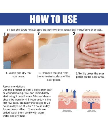 Men's Face Wash for Oily Skin + Silicone Scar Sheets for Breast Reduction - 8 Pack Scar Removal Sheets - Whipped Bath Soap Included - Buy Online on GoSupps.com