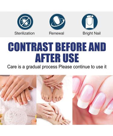 Tlopa Nail Growth And Strengthening Serum Nail Growth and Strength Serum Toenail Growth Treatment for Damaged Nail Stronger Nails in 1 Week Nail Strengthening Treatment (3PC) - Buy Online on GoSupps.com