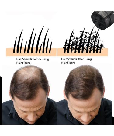 Natural Hair Loss Concealer - Hair Building Fibers for Men and Women 0.87oz (Black) - Buy Online on GoSupps.com