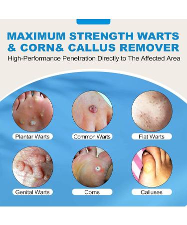 Fast Action Liquid Wart Gel - Maximum Strength Salicylic Acid Treatment for Warts Corns and Calluses - Fast-Acting Freeze Off Solution for All Wart Types - Buy Online on GoSupps.com